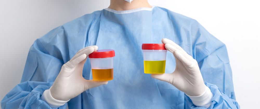 Cover image for Organ Preservation Solution Market Insights 2024: Innovations, Key Players, and Future Outlook