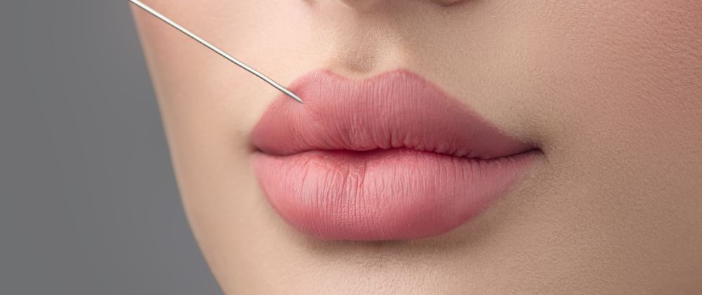 Cover image for How Do Russian Lip Fillers Differ from Regular Lip Fillers?