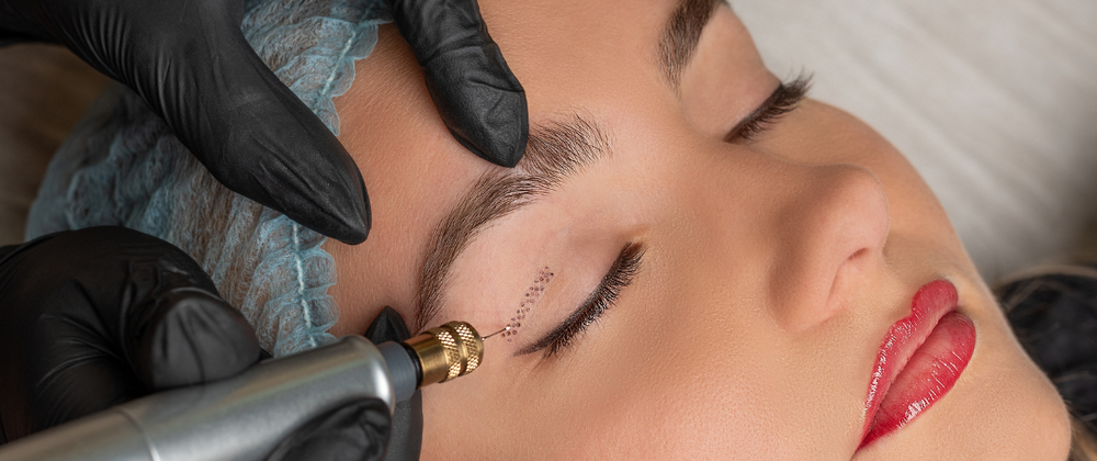 Cover image for What Age Is Best for Plasma Pen Treatment?