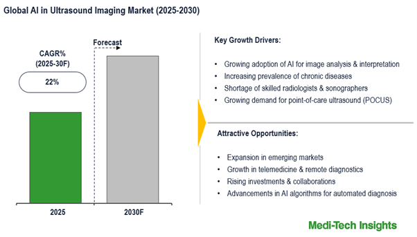 Cover image for Global AI in Ultrasound Imaging Market to Flourish at 22% CAGR, AI’s Role in Faster Scan Results by 2030