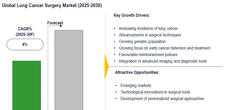 Cover image for Lung Cancer Surgery Market Overview: Future Prospects, Key Insights, and 4% CAGR by 2030