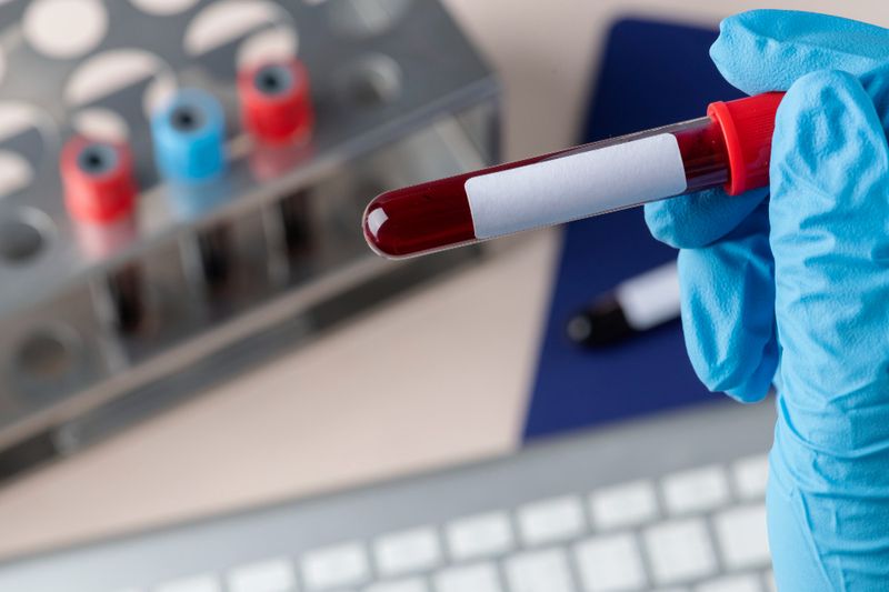 taking blood on tube for testing