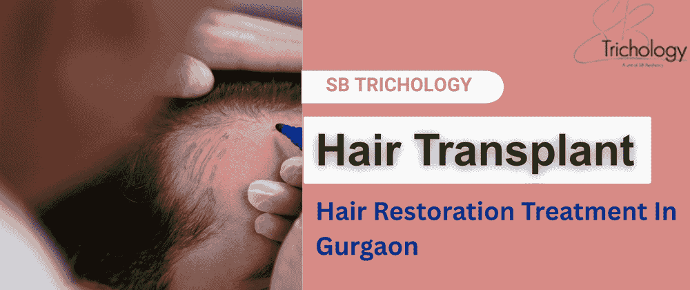Cover image for Why Is Hair Transplant An Amazing Hair Restoration Procedure?
