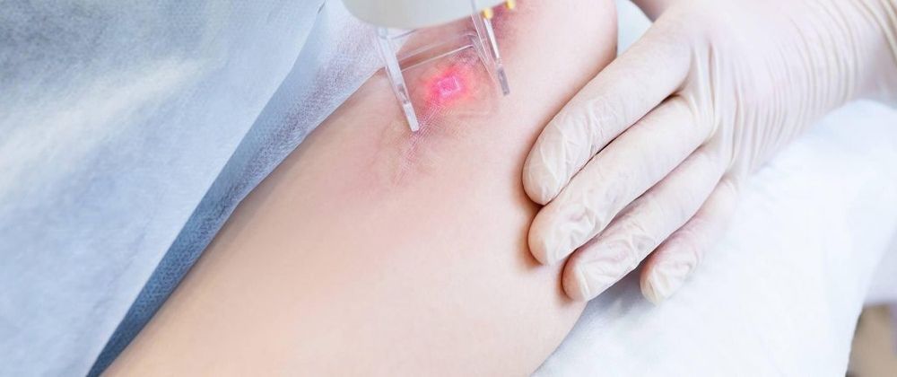 Cover image for Top Scar Removal Solutions in Studio City for Smooth Skin