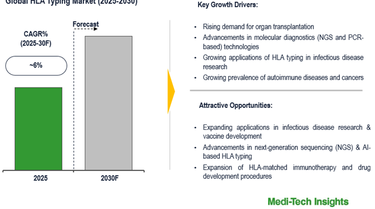 Cover image for Global HLA Typing Market: Projected 6% CAGR and Key Growth Factors Impacting the Market by 2030