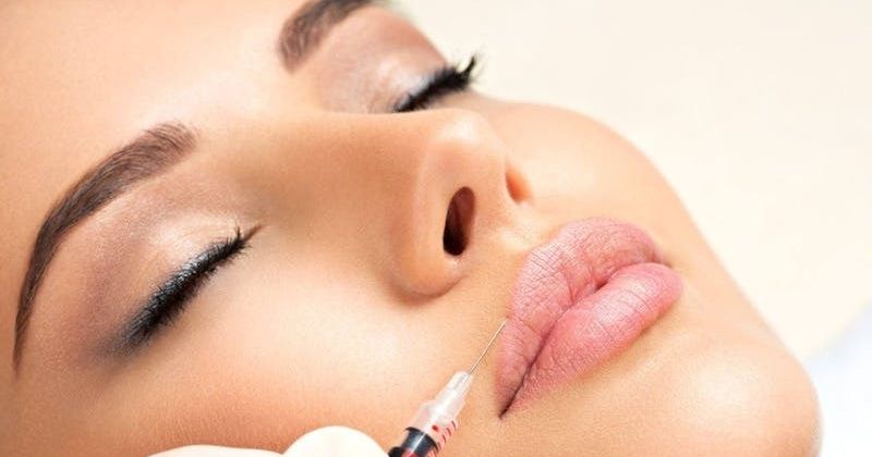 Cover image for Can Lip Fillers Correct Asymmetry or Thin Upper Lips?